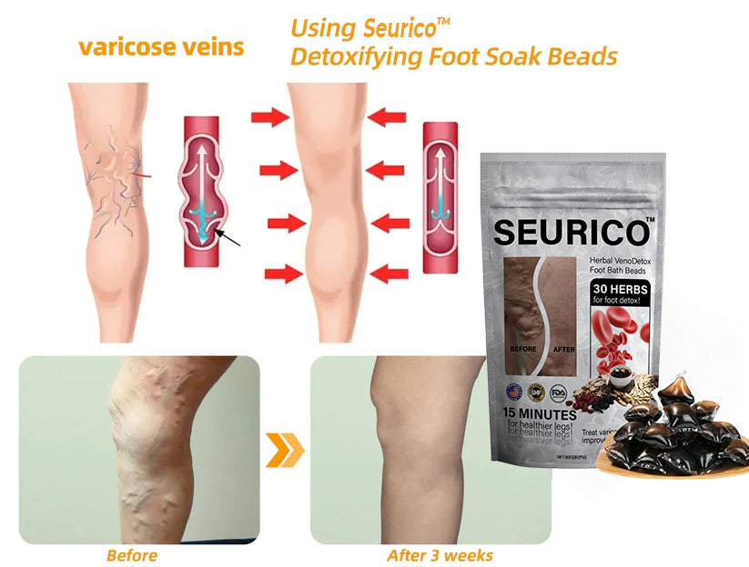 ๐ฟSeuricoโข Herbal VenoDetox Foot Bath Beads๐ฒ(๐๐๐๐ ๐๐๐ซ๐ญ๐ข๐๐ข๐๐๐ญ๐ข๐จ๐ง๏ผ๐๐๐บ๐ฝ๐ต๐ฎ๐๐ถ๐ฐ ๐๐๐๐ผ๐ฐ๐ถ๐ฎ๐๐ถ๐ผ๐ป ๐ผ๐ณ ๐๐บ๐ฒ๐ฟ๐ถ๐ฐ๐ฎ)