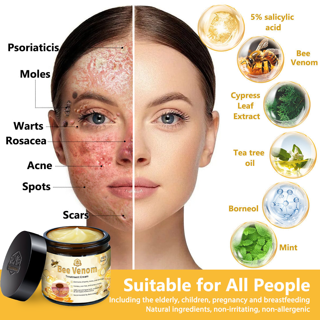 ๐ง๐๐ข๐ฃ๐ยฎ Bee Venom Skin Treatment Cream (AAD Recommended๐จโโ๏ธ)๐๐