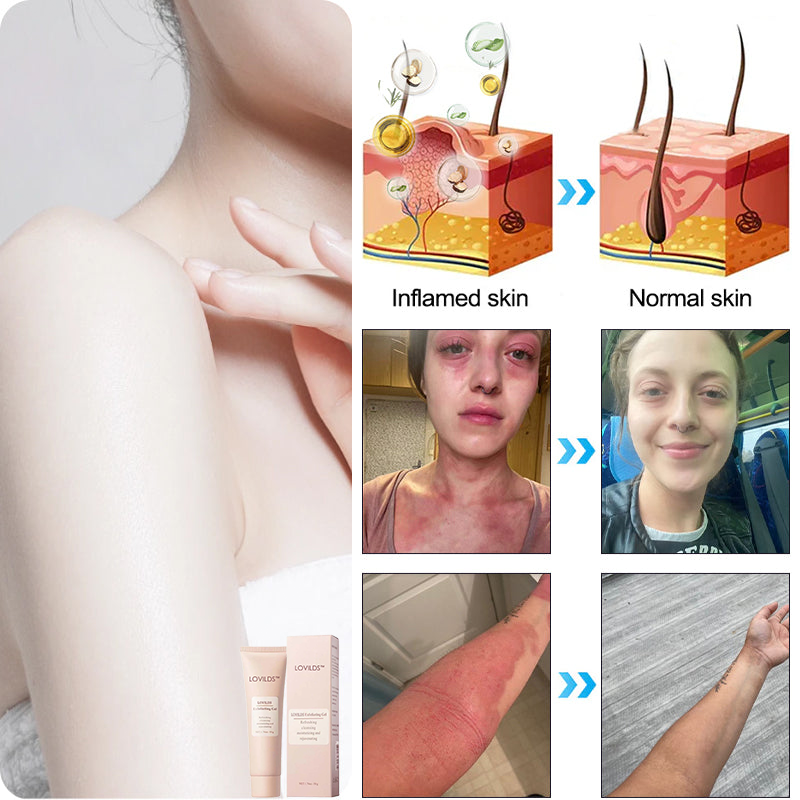 โจ๐๐๐ฌ๐ญ ๐๐๐ฒ ๐๐ข๐ฌ๐๐จ๐ฎ๐ง๐ญ: 90% ๐๐
๐
๐ฅ Seuricoโข Exfoliating Gel