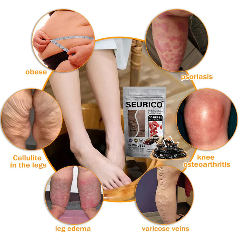 ๐ฟSeuricoโข Herbal VenoDetox Foot Bath Beads๐ฒ(๐๐๐๐ ๐๐๐ซ๐ญ๐ข๐๐ข๐๐๐ญ๐ข๐จ๐ง๏ผ๐๐๐บ๐ฝ๐ต๐ฎ๐๐ถ๐ฐ ๐๐๐๐ผ๐ฐ๐ถ๐ฎ๐๐ถ๐ผ๐ป ๐ผ๐ณ ๐๐บ๐ฒ๐ฟ๐ถ๐ฐ๐ฎ)