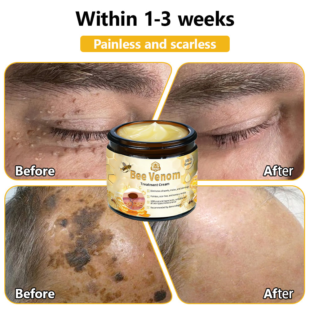 ๐ง๐๐ข๐ฃ๐ยฎ Bee Venom Skin Treatment Cream (AAD Recommended๐จโโ๏ธ)๐๐