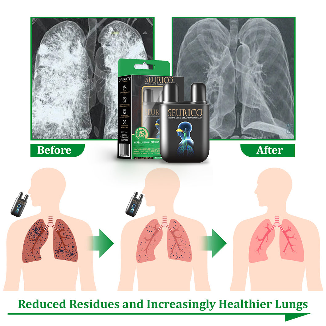 💜✅Official Store Seurico™ herbal lung cleansing inhaler 👨⚕️FDA Certification(💝 Cough, wheezing, shortness of breath, sputum, stuffy nose, bronchitis, bronchitis, allergy symptoms, lung discomfort💝)