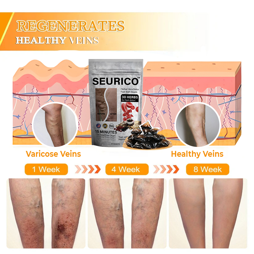 ๐ฟSeuricoโข Herbal VenoDetox Foot Bath Beads๐ฒ(๐๐๐๐ ๐๐๐ซ๐ญ๐ข๐๐ข๐๐๐ญ๐ข๐จ๐ง๏ผ๐๐๐บ๐ฝ๐ต๐ฎ๐๐ถ๐ฐ ๐๐๐๐ผ๐ฐ๐ถ๐ฎ๐๐ถ๐ผ๐ป ๐ผ๐ณ ๐๐บ๐ฒ๐ฟ๐ถ๐ฐ๐ฎ)