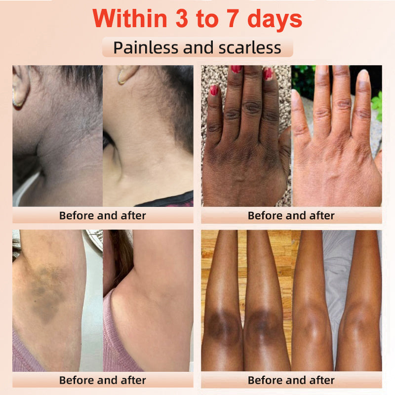 ✨𝐋𝐚𝐬𝐭 𝐃𝐚𝐲 𝐃𝐢𝐬𝐜𝐨𝐮𝐧𝐭: 90% 𝐎𝐅𝐅🔥 Seurico™ Exfoliating Gel