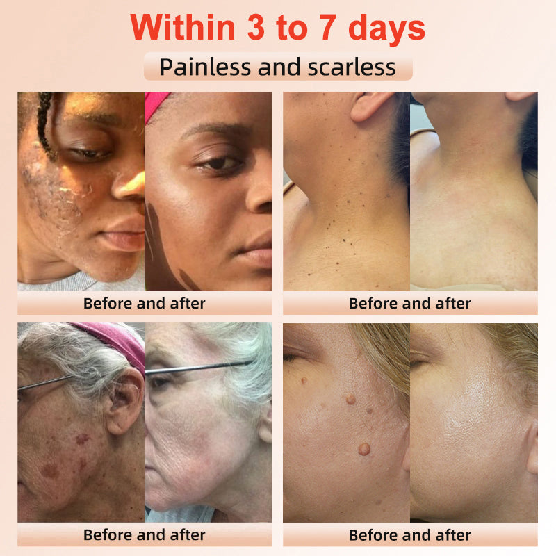 ✨𝐋𝐚𝐬𝐭 𝐃𝐚𝐲 𝐃𝐢𝐬𝐜𝐨𝐮𝐧𝐭: 90% 𝐎𝐅𝐅🔥 Seurico™ Exfoliating Gel