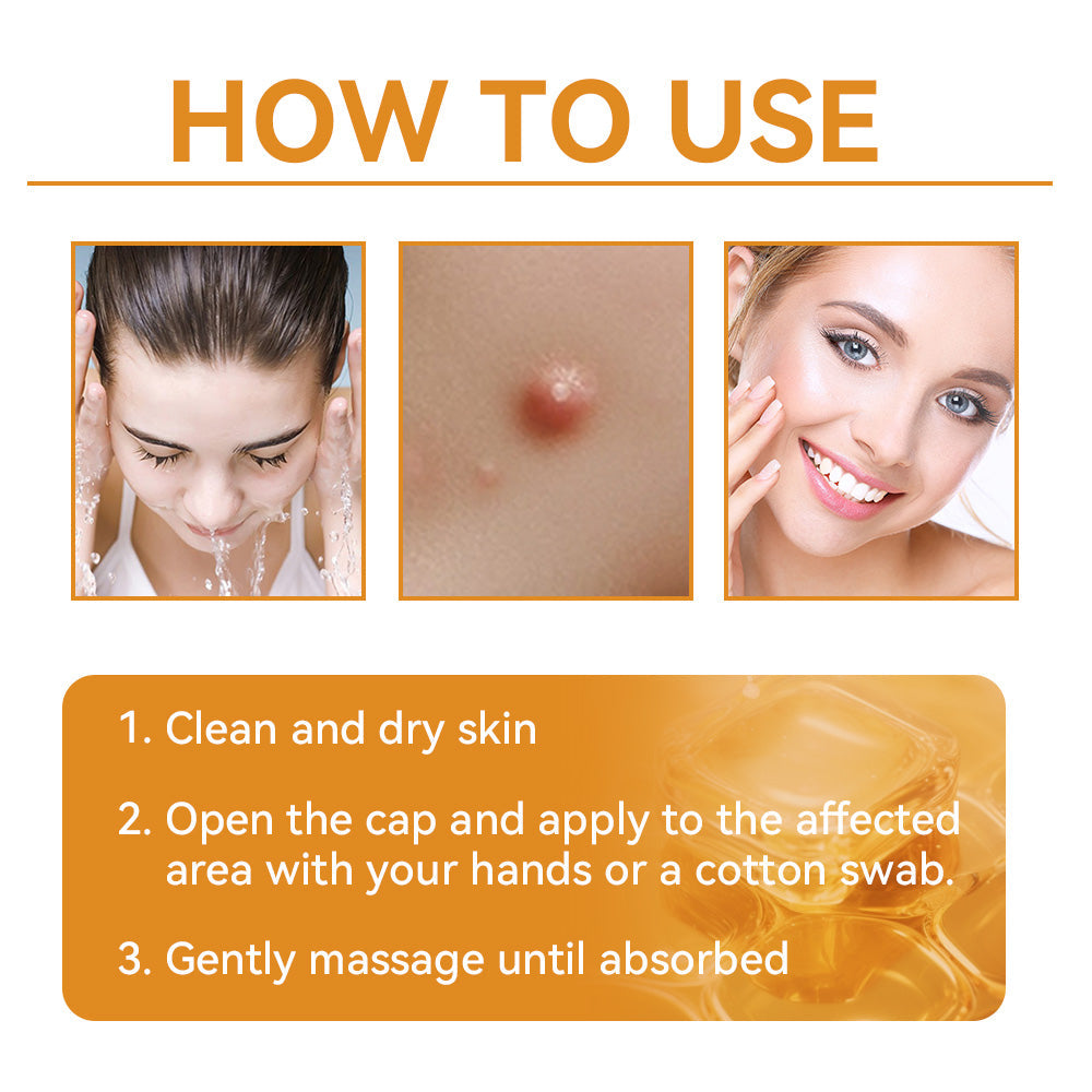 𝗧𝗟𝗢𝗣𝗔® Bee Venom Skin Treatment Cream (AAD Recommended👨‍⚕️)💖💟