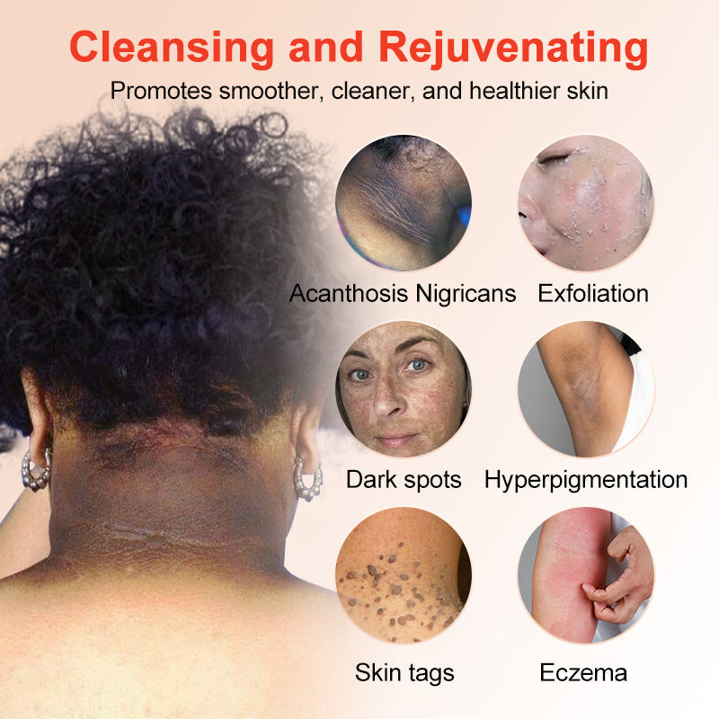 ✨𝐋𝐚𝐬𝐭 𝐃𝐚𝐲 𝐃𝐢𝐬𝐜𝐨𝐮𝐧𝐭: 90% 𝐎𝐅𝐅🔥 Seurico™ Exfoliating Gel