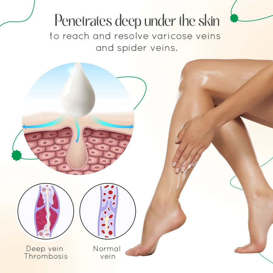 Vasculear™ Vein Therapy Cream
