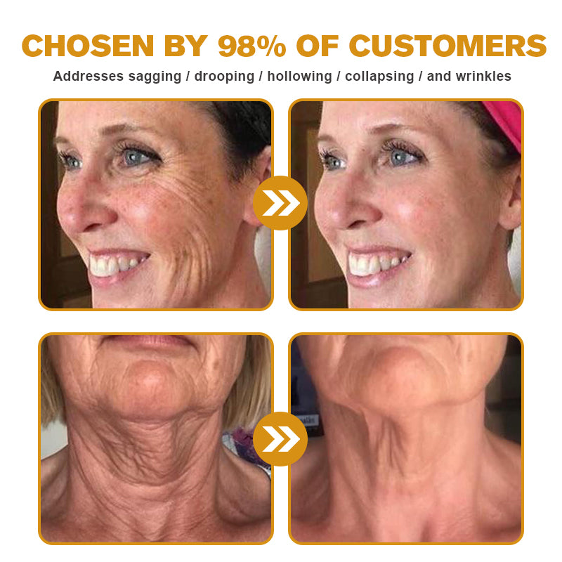 🐄Seurico™ Grass Fed Tallow Balm for Skin Tightening