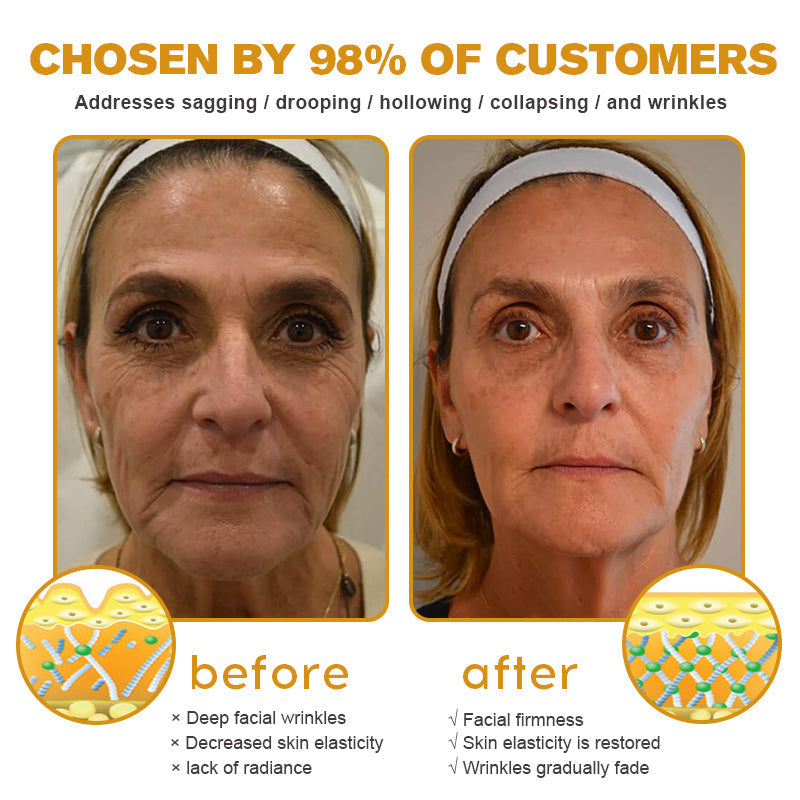 🐄Seurico™ Grass Fed Tallow Balm for Skin Tightening