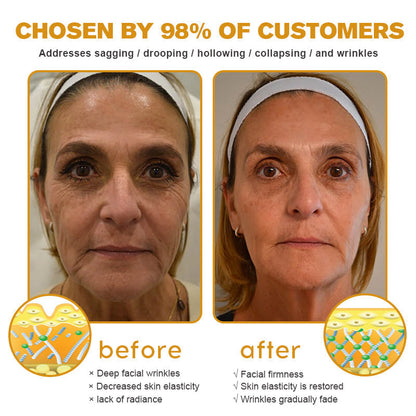 🐄Seurico™ Grass Fed Tallow Balm for Skin Tightening