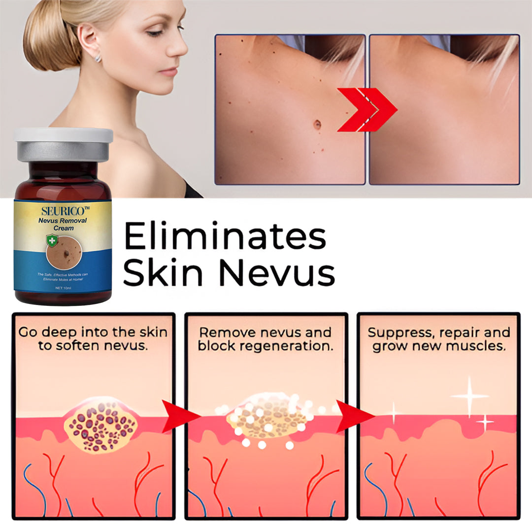 🌿 Seurico™ Nevus Removal Treatment Cream